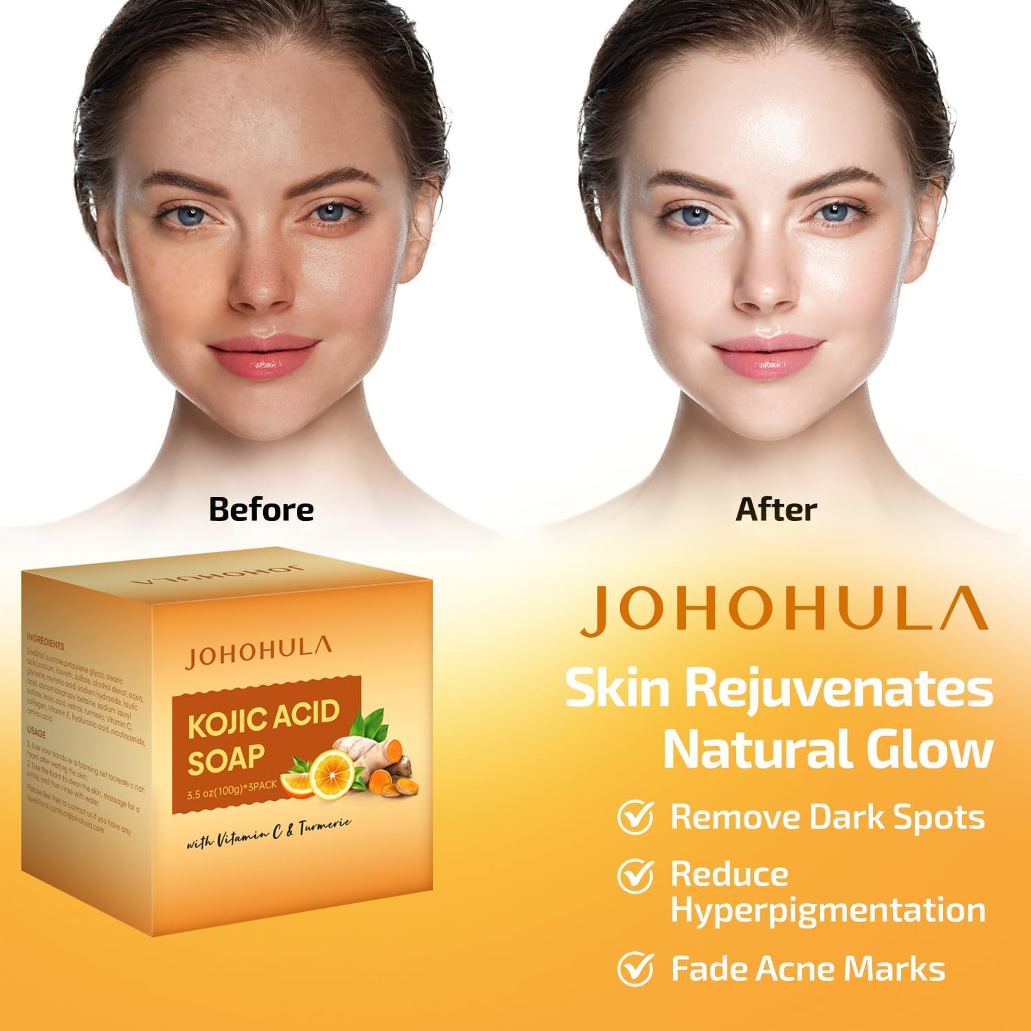 Johohula Kojic Acid Dark Spot Remover Soap Bars with Vitamin C, Retinol, Collagen, Turmeric - Smooth for Face and Body, Firm and smooth skin - 3 X 100g Bars
